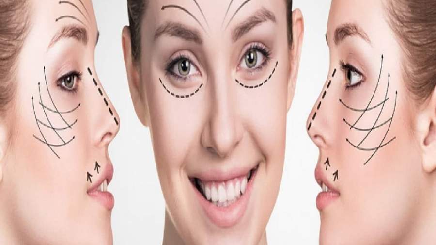 تقلیدی که زنان ایرانی را شبیه هم کرده است