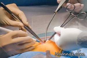 می دانید بهترین ساعت روز برای جراحی چه زمانی است