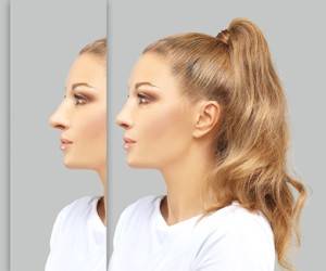 جراحی بینی از دیدگاه دکتر آرش نجف بیگی