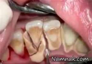 عاقبت 10 سال مسواک نزدن + فیلم
