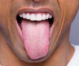 زبان بیماری را نشان می دهد!