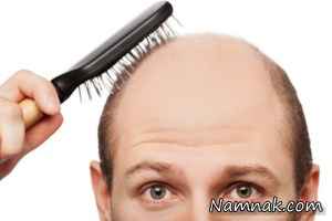 بهترین درمانهای خانگی ریزش مو