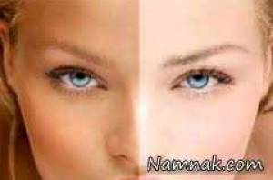 پوست صاف و بدون جوش با طب سنتی