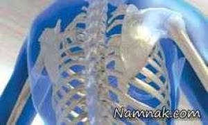 با این روش ها از پوکی استخوان جلوگیری کنید