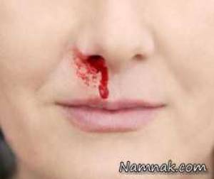 همه ی آن چیز هایی که باید در باره ی عوامل خون دماغ شدن تا درمان آن بدانید