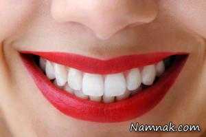 سفید شدن دندان با راههای خانگی