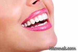 اصلاح طرح لبخنددندان برای خانم ها