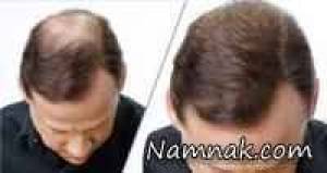 توصیه امامان برای تقویت و پرپشت شدن مو