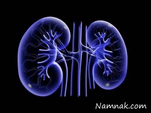 خارج کردن تومور 7 کیلویی از کلیه یک زن