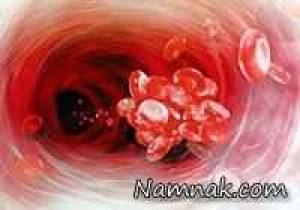 همه انچه که باید درباره پیشگیری تا کنترل چربی خون بدانید