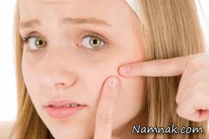 آکنه صورت نشان دهنده ی چه مشکلی در بدن می باشد؟