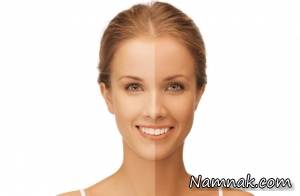 برنزه کردن برای تولید ویتامین D مضر است یا مفید