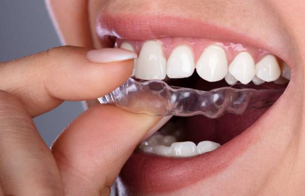 تمام آنچه باید درباره نایت گارد بدانید نایت گارد چیست