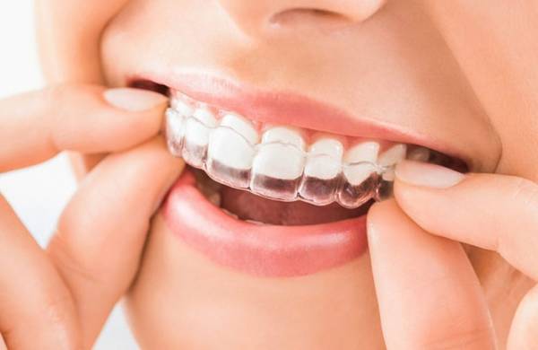 نایت گارد برای محافظت از مینای دندان کاربردهای نایت گارد