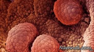 نوعی ادویه هندی که بدخیم ترین سرطانها را درمان میکند