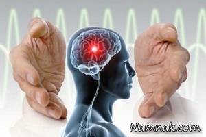 فیزیوتراپی و سکته مغزی