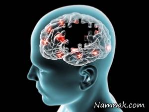 قرص&nbsp;سافینامید&nbsp;داروی پارکینسون
