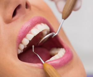 آشنایی با انواع متخصصان دندانپزشکی و کار هر یک