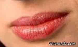 علت خشکی لب ها چیست؟