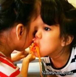 چالش جداسازی دوقلوهای از صورت به هم چسبیده برای پزشکان جهان