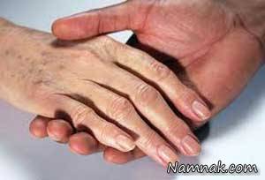 آنژیوما به چه نوع عارضه پوستی گفته می شود