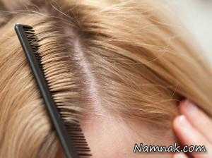 مشکلات مو و دلیل انواع مشکلات ریزش و نازیبایی موهای سر