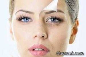 استرس پوست شما را به چه روزی می اندازد؟