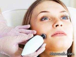 عکس واقعی از لیزر موهای زائد