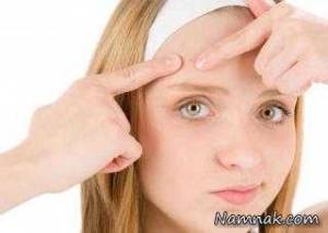 10 کار اشتباه موقع جوش زدن صورت