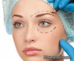 مشکلات دور چشم