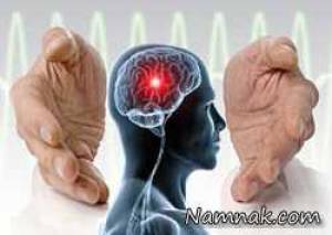 ساعات و زمان حیاتی بعد از سکته مغزی