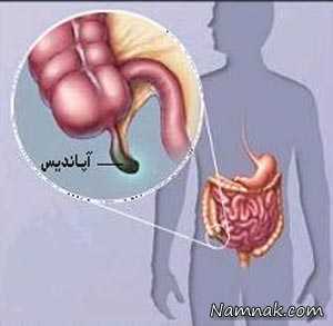 کار اصلی آپاندیس در بدن