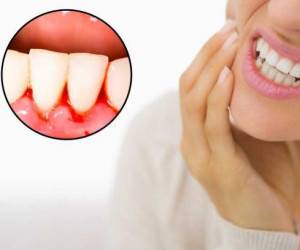 &nbsp;دلایل خطرناک و شایع خونریزی لثه