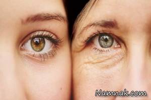 بهترین نسخه های گیاهی برای رفع چین و چروک با تغذیه