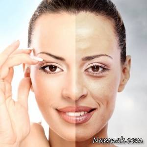 علت داشتن پوست زشت و زیبا چیست