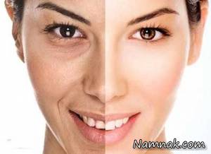چروک شدن پوست با تغذیه نامناسب