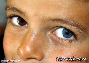 پسری با رنگ چشم های متفاوت از هم!