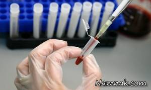 آزمایش تشخیص ایدز را چند بار و چه زمانی باید انجام داد