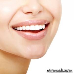 برای داشتن لبخند جذاب 14 نکته را رعایت کنید