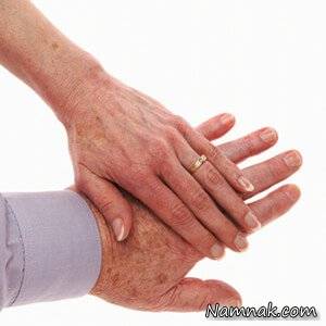 8 راه طبیعی برای درمان لکه های آفتاب در روی دست