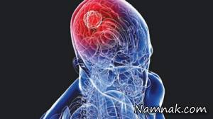حقایقی درباره مغز که پاهایتان می گویند