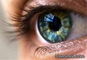 تغیییرات در فشار چشم-گزینه های علل و درمان آن