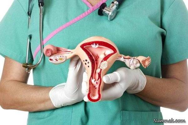 دفع لخته خون در دوران ماهانه