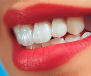 راز خانم هایی که همیشه دندان هایشان سفید و زیباست چیست؟