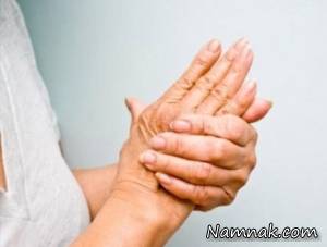 آرتریت روماتوئید در زنان شایع تر است
