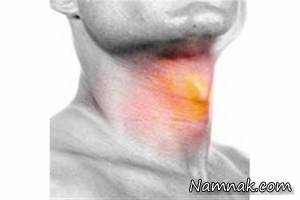 هرگونه تغییر و گرفتگی صدا ممکن است خطر ساز باشد