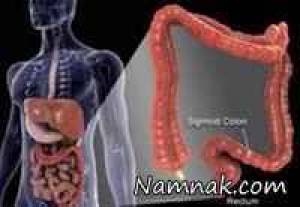 کولون روشی برای تمیز کردن روده بزرگ