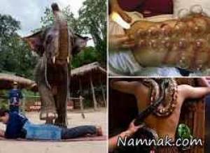 باور نکردنی ترین روش های درمان ! + تصاویر