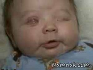 تولد نوزادی بدون چشم + تصاویر