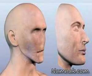 &nbsp;جراحی و پیوند صورت